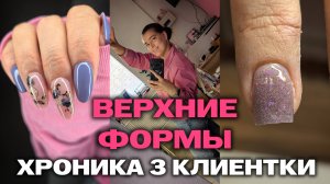 Коррекция ногтей с верхними формами | Что делают клиенты | Хроника ногтей | Этапы маникюра