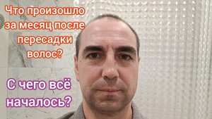 Пересадка волос. Поэтапно месяц после пересадки.