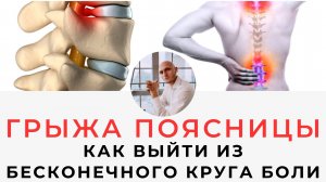 Грыжа Как выйти из бесконечного круга постоянных болей | Реабилитолог Павел Артемьев