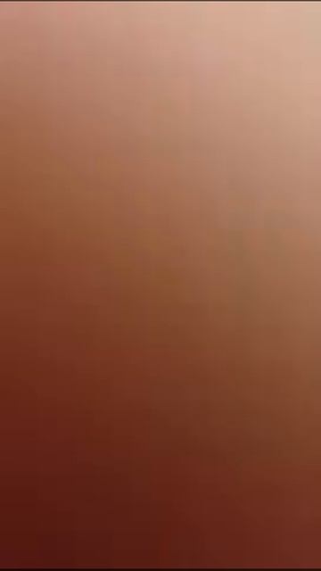 Vlog:кровь!!!!!!