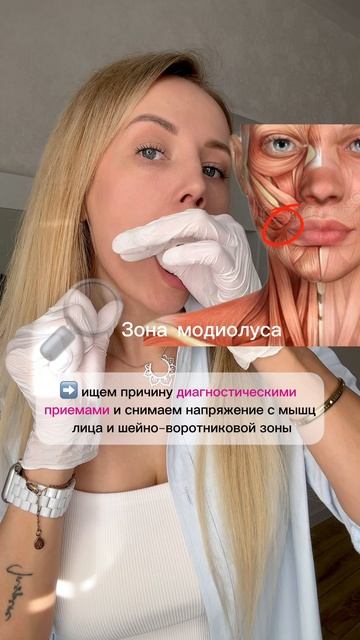 Асимметрия лица