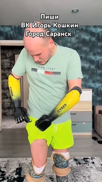 Протезы 🦾Игорь Кошкин. Саранск смотреть онлайн