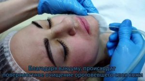 Вакуумная чистка лица с озонизацией