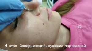 Механическая чистка