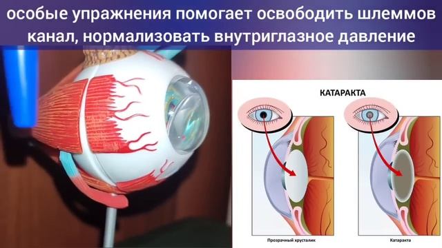 Падает зрение, деградируют сетчатка и хрусталик? Укре?