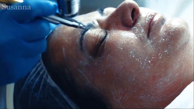 Коррекция второго подбородка в Липецке (Криолиполиз) смотреть онлайн