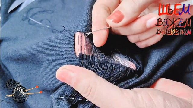 Устраняем сложный разрыв смотреть онлайн