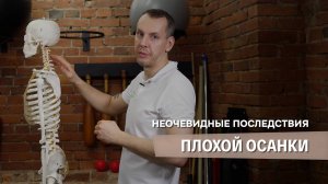 Нарушения осанки — Неочевидные последствия плохой осанки