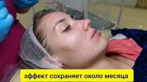 Комплексная программа "анти-акне"