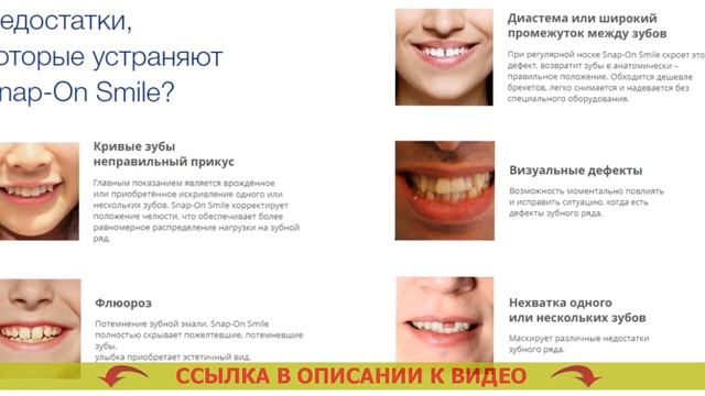 😁 ВИНИРЫ ЦЕНА В КАЗАХСТАНЕ смотреть онлайн