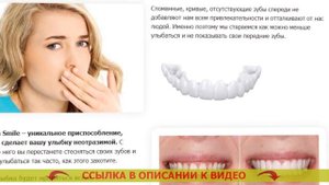 😬 Как использовать зубные виниры 🔔 Как пользоваться