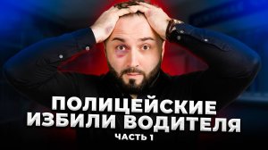 Избит. Запуган. Обвинён. Что будет дальше? ЧАСТЬ 1 | Малмыж