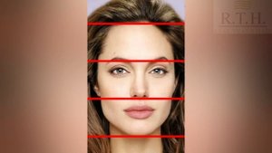 Эндоскопический лифтинг бровей