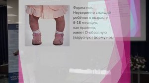 Фролов В  А  – Индивидуальные супинаторы полного контакта в комплексной реабилитации детей