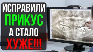 Фатальная Ошибка при Исправлении Прикуса