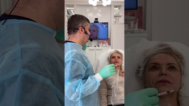 Коррекция ботулотоксином межбровья, мимических морщи