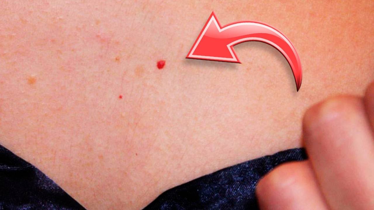 🔴 Красные точки на коже причины и как избавиться быстро