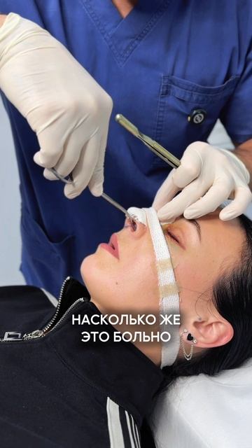 Больше про Ринопластику и другие операции у меня в профиле, переходи и смотри😉