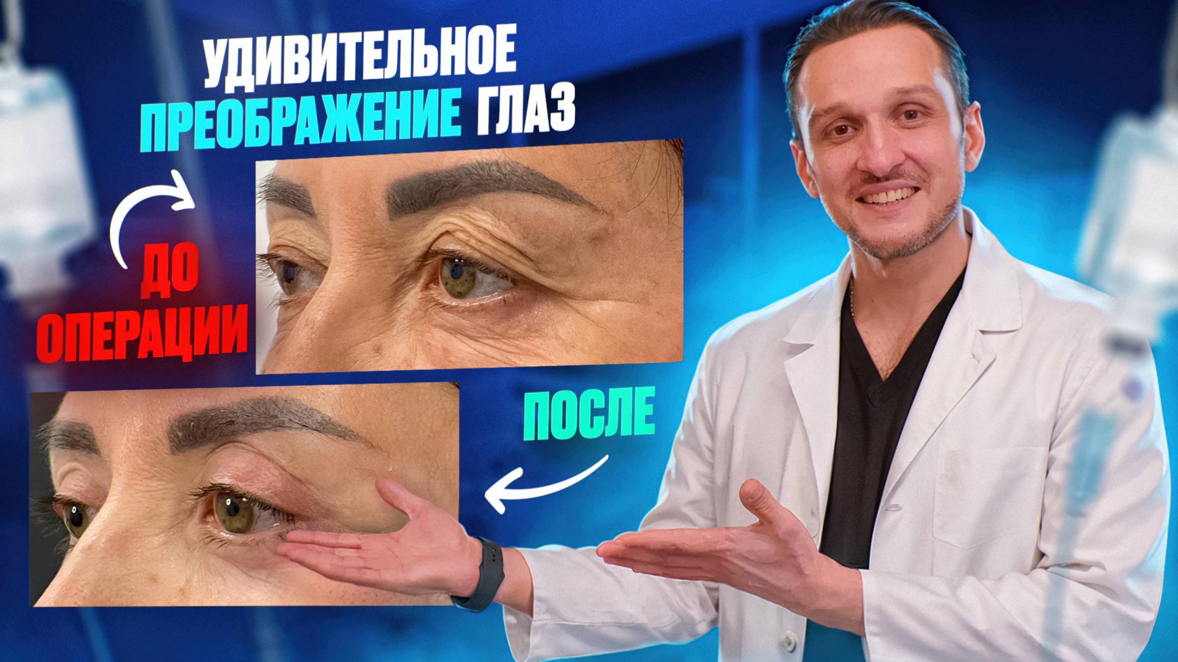 ПОСМОТРИ прежде , чем СДЕЛАТЬ! | БЛЕФАРОПЛАСТИКА