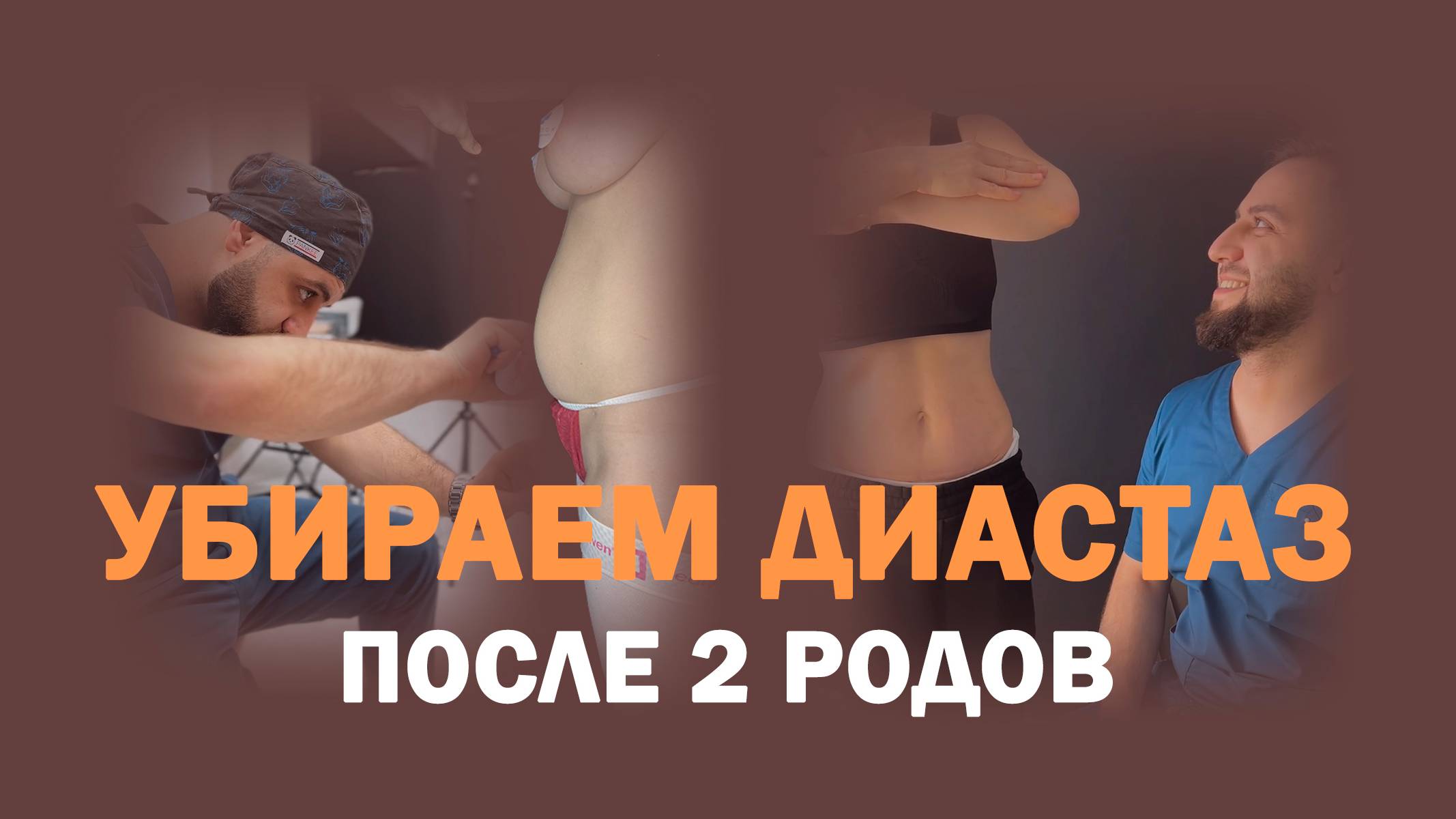 Живот после родов: как вернуть тонус без липосакции и видимых шрамов