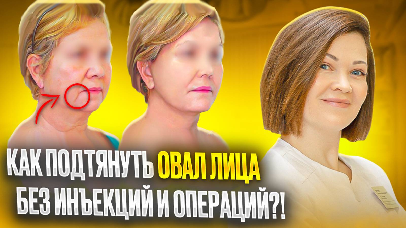Секрет СМАС-лифтинга для молодости без хирургии!