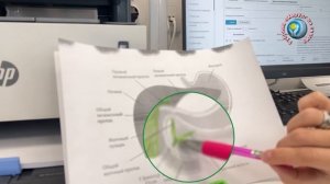 Жизнь без желчного пузыря_ советы и рекомендации