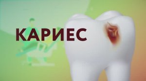 Кариес / «Это должен знать каждый»