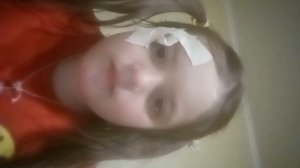 я не буду снимать видео с лицом когда этот фингал не заживёт