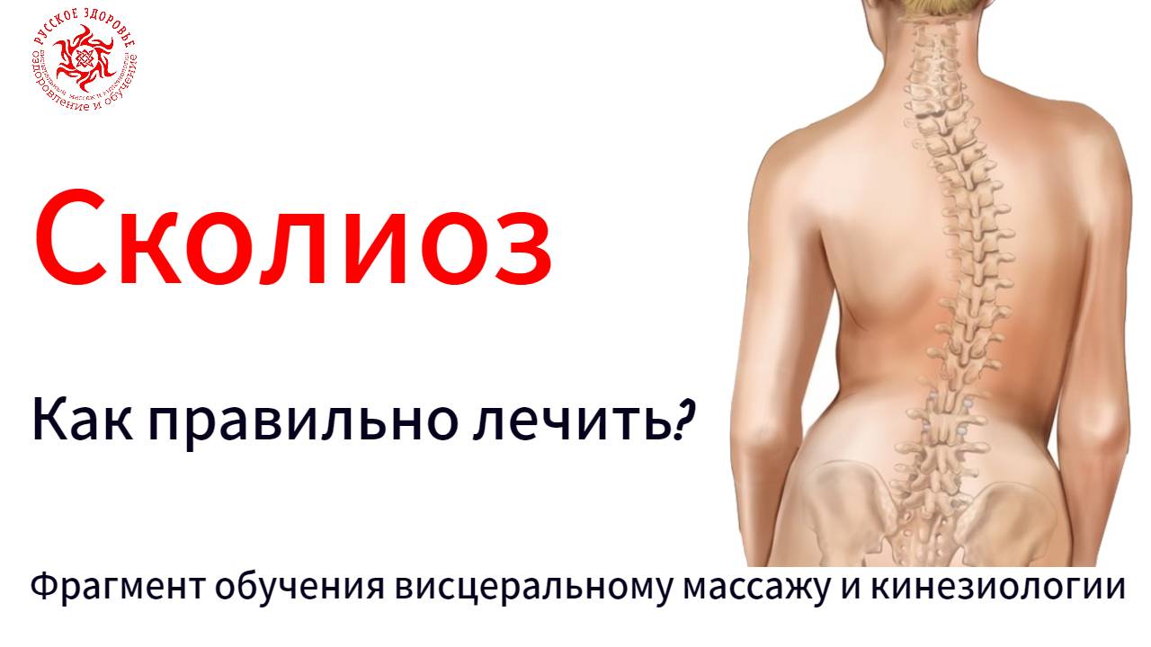 Сколиоз. Как правильно лечить? Фрагмент обучения висцеральному массажу и кинезиологии.