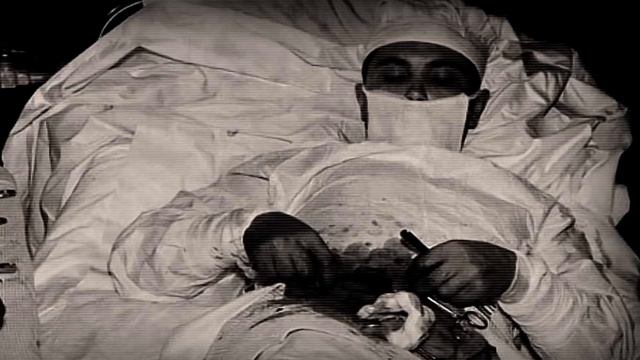 Два часа НА ГРАНИ: самая ЭКСТРЕМАЛЬНАЯ операция в исто смотреть онлайн