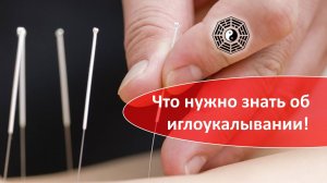 524 Что нужно знать об иглоукалывании 09