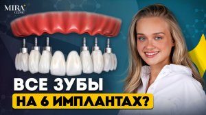 ВСЕ ЗУБЫ на 6 имплантах - All-on-6! ВСЯ ПРАВДА