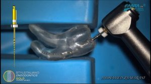 Mohamed Zafrany  Обработка корневых каналов инструментами Fanta