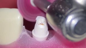 bredent | SKY ELEGANCE BioHPP | Протокол работы