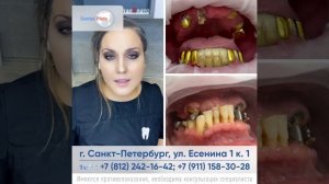 кому подойдет all on 4