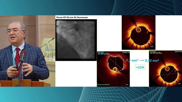 Бабунашвили А.М.Анализ 7-летнего  опыта работы клиники ЦЭЛТ со  службой СМП Московской  области по л