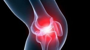 Почему хрустят колени и что с этим делать?