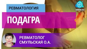 Ревматолог Смульская О.А.: Подагра