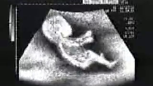 Прикол- эмбрион смотреть онлайн