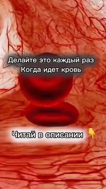 Остановить кровь #гнм #германскаяноваямедицина #психология #психосоматикаболезней