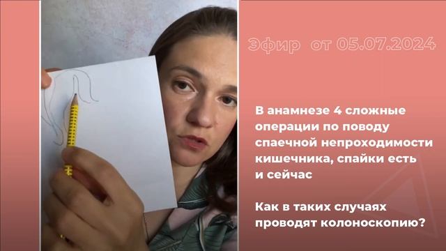 Как при спайках проводят колоноскопию?