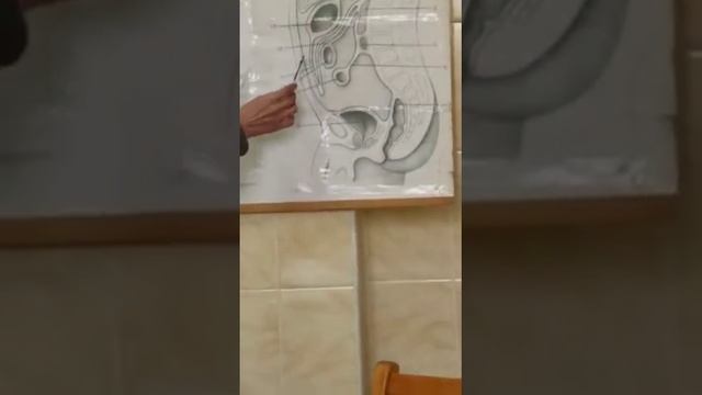 Брюшина смотреть онлайн