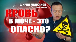 КРОВЬ🩸 в моче - это опасно? Ширип Малханов уролог-андролог #урология #андролог #мужскоездоровье