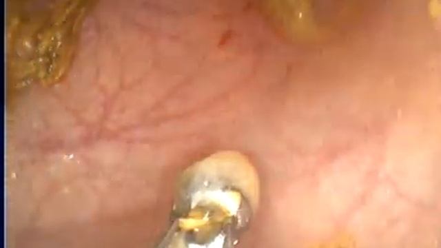 Колоноскопия у кошки . Ветеринарная клиника "Эндовет" ? смотреть онлайн