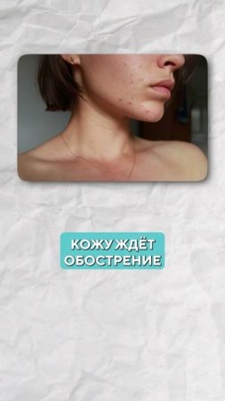 Не загорай на солнце, пока не узнаешь ЭТО! #красота #молодость #акне