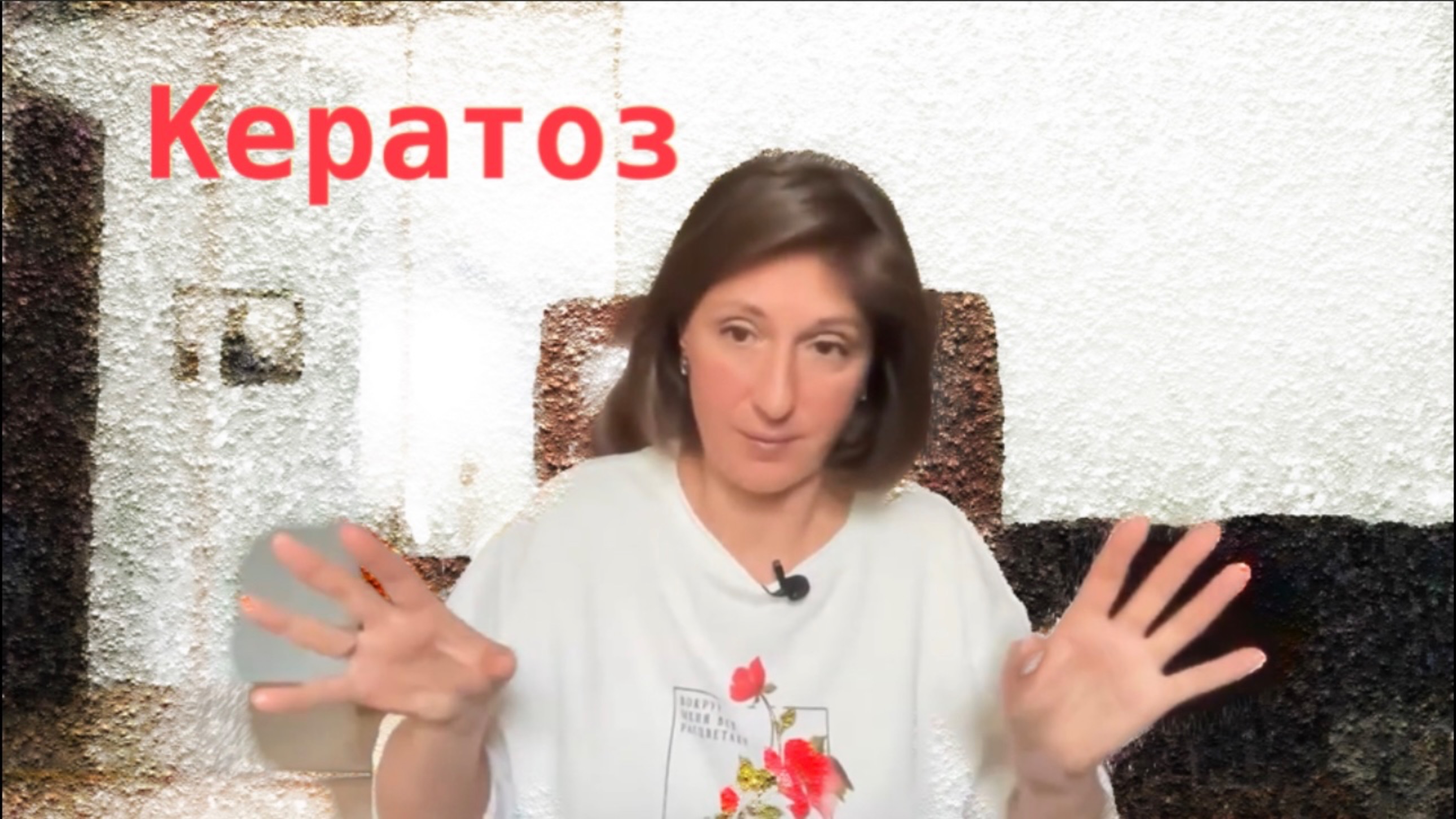Кератоз: причины, как избавиться