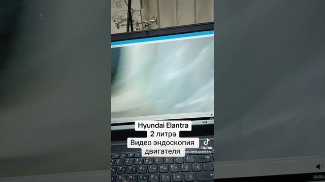 Видео эндоскопия двигателя Hyundai Elantra смотреть онлайн