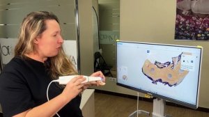 Обзор интраорально сканера CAMEO rapid 3 (Aidite, Китай)