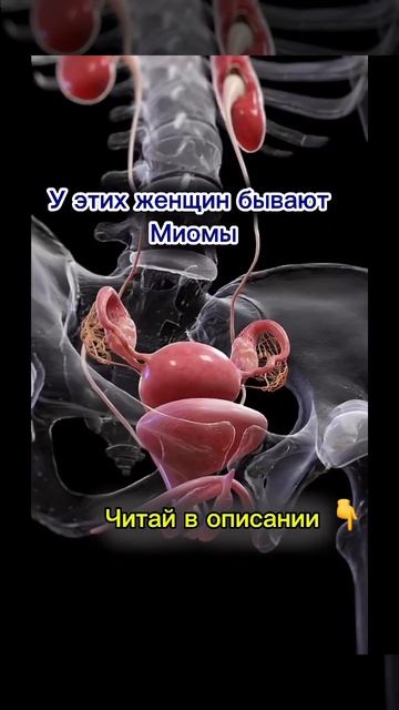 Миома по ГНМ #германскаяноваямедицина #психология #гнм #психосоматикаболезней