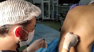 Спинномозговая анестезия Выполняет анестезиолог Неъ